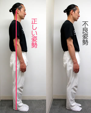 正しい姿勢・不良姿勢