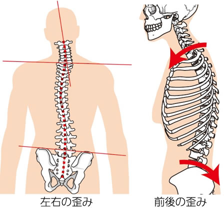 前後の歪みと左右の歪み