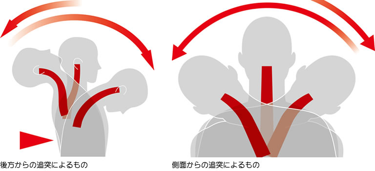 交通事故による「むち打ち」の図解 追突によるむち打ち